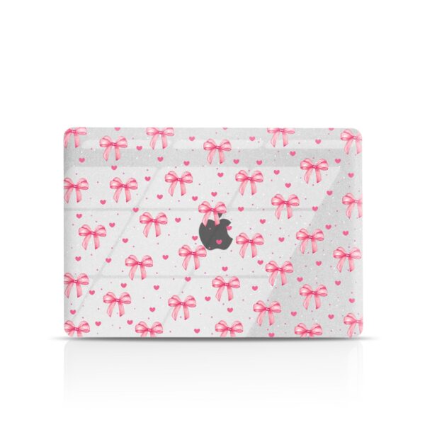 Bow Crush MacBook Case - Payfisia