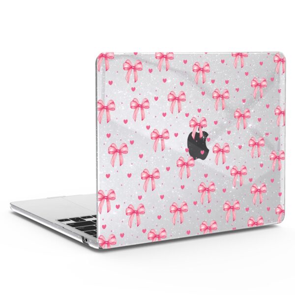 Bow Crush MacBook Case - Payfisia